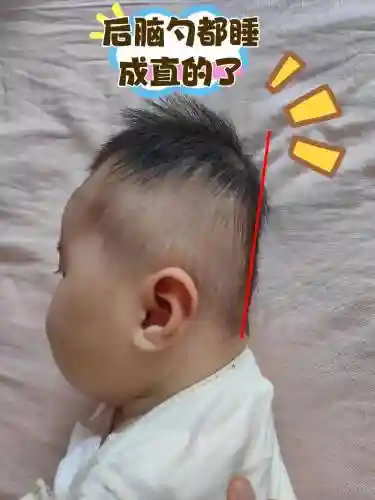 扁头阵容插图1