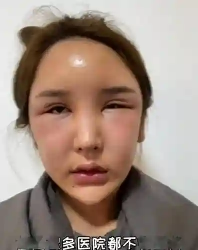 阵容失败脸_1插图1